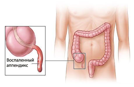 ภาคผนวก