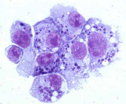 เชื้อโรคจากมนุษย์ anaplasmosis (ครอบครัว Anaplasmataceae)