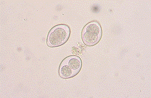 Coccidia - สาเหตุของ coccidioidosis