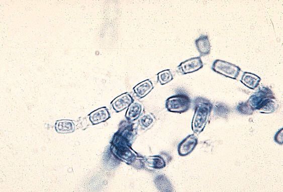 Paracoccidia เป็นสาเหตุของเชื้อ Paracoccidioidosis