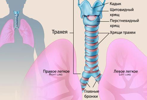 tracheitis ในเด็กคืออะไร? ภาพถ่ายของหลอดลมหลอดลม