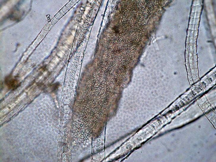 เชื้อโรคจาก epidermophytosis